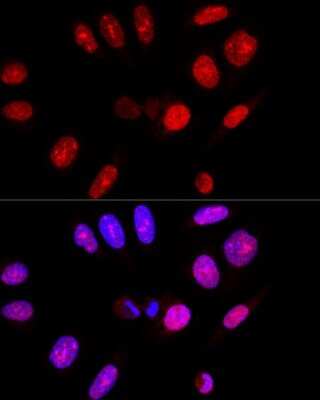Immunocytochemistry/ Immunofluorescence: Ataxin-3 Antibody - Azide and BSA Free [NBP2-92853]