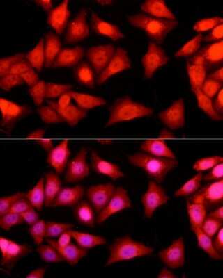 Immunocytochemistry/ Immunofluorescence: Ataxin-3 Antibody - Azide and BSA Free [NBP2-92853]