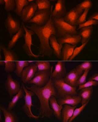 Immunocytochemistry/ Immunofluorescence: Ataxin-3 Antibody - Azide and BSA Free [NBP2-92853]