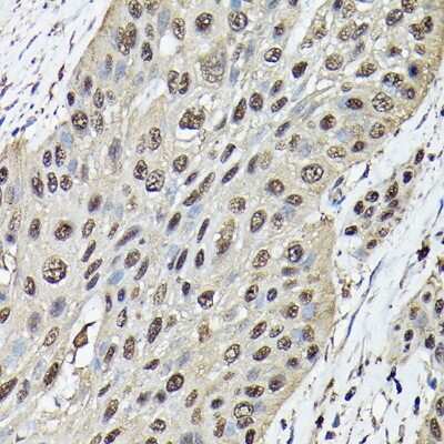 Immunohistochemistry-Paraffin: Ataxin-3 Antibody - Azide and BSA Free [NBP2-92853]