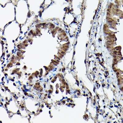 Immunohistochemistry-Paraffin: Ataxin-3 Antibody - Azide and BSA Free [NBP2-92853]