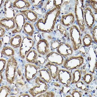 Immunohistochemistry-Paraffin: Ataxin-3 Antibody - Azide and BSA Free [NBP2-92853]