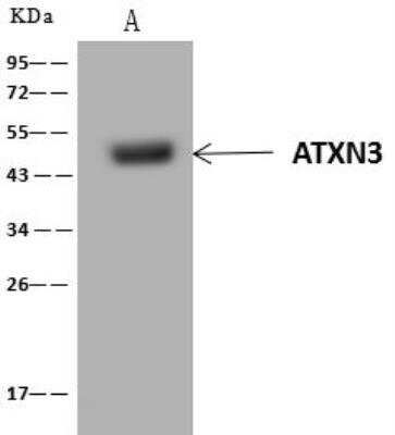 Immunoprecipitation: Ataxin-3 Antibody [NBP3-12686]