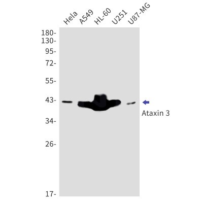 Western Blot: Ataxin-3 Antibody (S04-1I8) [NBP3-19834]