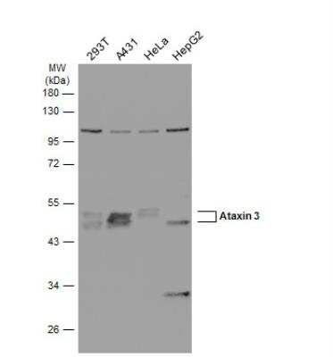 Western Blot: Ataxin-3 Antibody [NBP1-32083]