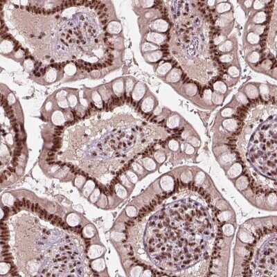 Immunocytochemistry/ Immunofluorescence: Ataxin 7-Like 3 Antibody [NBP2-56183]