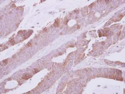 Immunohistochemistry-Paraffin: Atpalpha Antibody [NBP2-42816]