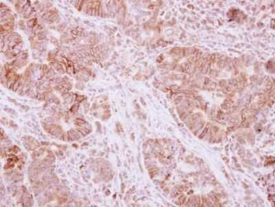 Immunohistochemistry-Paraffin: Atpalpha Antibody [NBP2-42817]