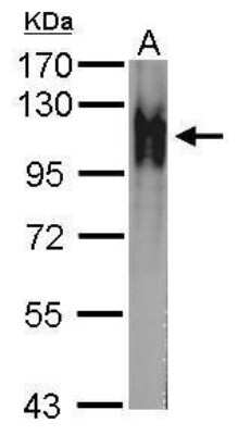 Western Blot: Atpalpha Antibody [NBP2-42816]