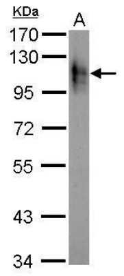 Western Blot: Atpalpha Antibody [NBP2-42817]