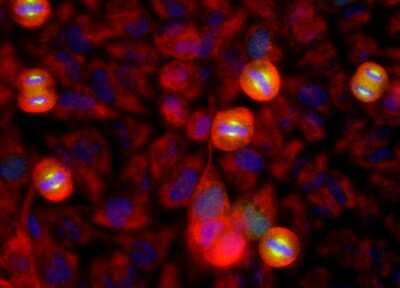 Immunocytochemistry/ Immunofluorescence: Aurora A Antibody (1A11) [NBP2-50040]