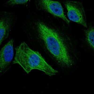 Immunocytochemistry/ Immunofluorescence: Aurora A Antibody (1F8) - Azide and BSA Free [NBP2-80587]
