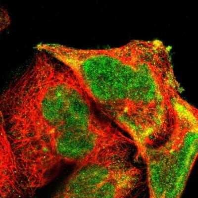 Immunocytochemistry/ Immunofluorescence: Aurora A Antibody [NBP1-90103]