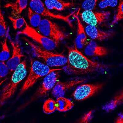 Immunocytochemistry/ Immunofluorescence: Aurora B Antibody (3F11) [NBP2-50039]