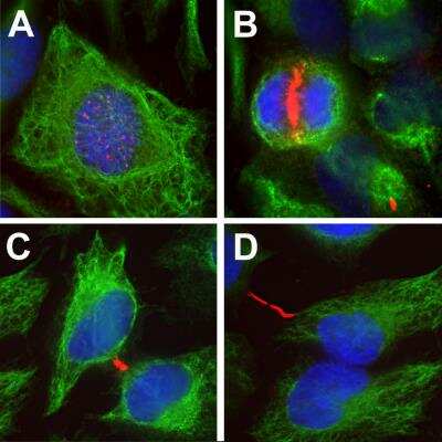Immunocytochemistry/ Immunofluorescence: Aurora B Antibody (6G2) [NBP2-50054]