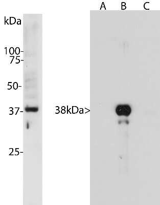 Western Blot: Aurora B Antibody (6G2) [NBP2-50054]