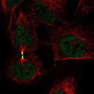Immunocytochemistry/ Immunofluorescence: Aurora B Antibody [NBP2-55144]