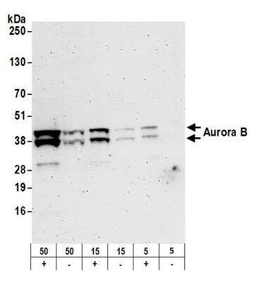 Western Blot: Aurora B Antibody [NB500-185]