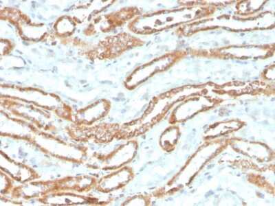 Immunohistochemistry-Paraffin: Aurora B Antibody (rAURKB/1592) - Azide and BSA Free [NBP3-08877]