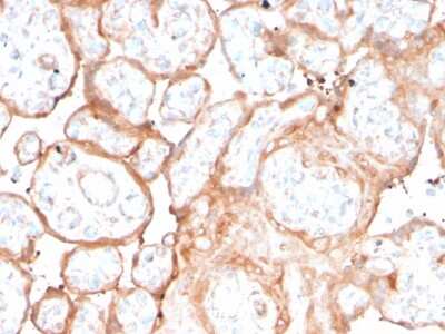 Immunohistochemistry-Paraffin: Aurora B Antibody (rAURKB/1592) [NBP3-07553]