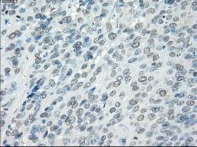 Immunohistochemistry-Paraffin: Aurora C Antibody (OTI2B7) [NBP1-47663]