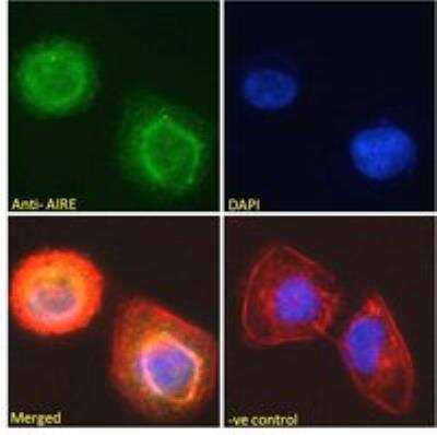 Immunocytochemistry/ Immunofluorescence: Autoimmune Regulator/AIRE Antibody [NB100-1063]