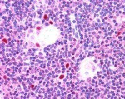 Immunohistochemistry-Paraffin: Autoimmune Regulator/AIRE Antibody [NB100-40799]