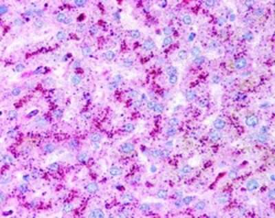 Immunohistochemistry: Autophagy Antibody Pack [NB910-94877]