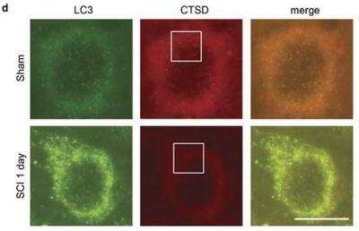 Immunohistochemistry: Autophagy Antibody Pack [NB910-94877]