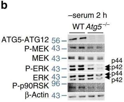 Knockout Validated: Autophagy Antibody Pack [NB910-94877]