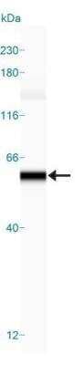 Simple Western: Autophagy Antibody Pack [NB910-94877]