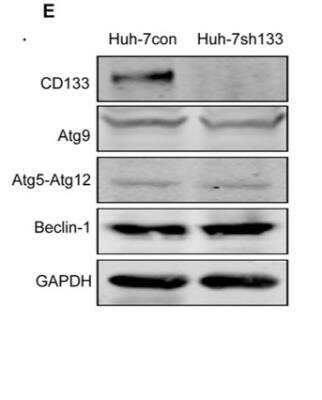 Western Blot: Autophagy Antibody Pack [NB910-94159]