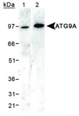 Western Blot: Autophagy Antibody Pack [NB910-94877]