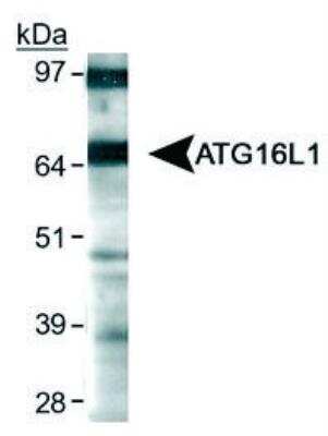 Western Blot: Autophagy Antibody Pack [NB910-94877]