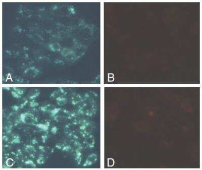 Functional: Autophagy/Cytotoxicity Dual Staining Kit [KA1299]