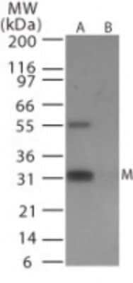 Western Blot: Avian Flu M1 Antibody [NB100-56610]