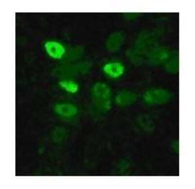 Immunocytochemistry/ Immunofluorescence: Avian Influenza A Hemagglutinin Antibody Pack [NBP2-25066]