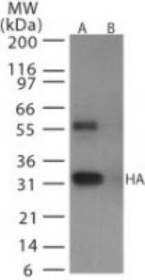 Western Blot: Avian Influenza A Hemagglutinin Antibody Pack [NBP2-25066]
