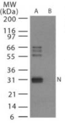 Western Blot: Avian Influenza A Hemagglutinin Antibody Pack [NBP2-25066]