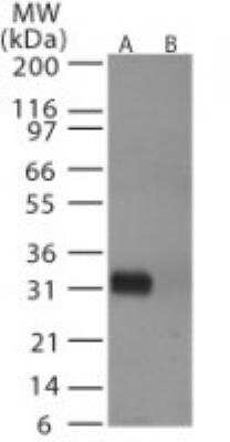 Western Blot: Avian Influenza A Hemagglutinin Antibody Pack [NBP2-25066]