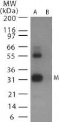 Western Blot: Avian Influenza A Hemagglutinin Antibody Pack [NBP2-25066]