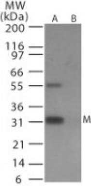 Western Blot: Avian Influenza A Hemagglutinin Antibody Pack [NBP2-25066]