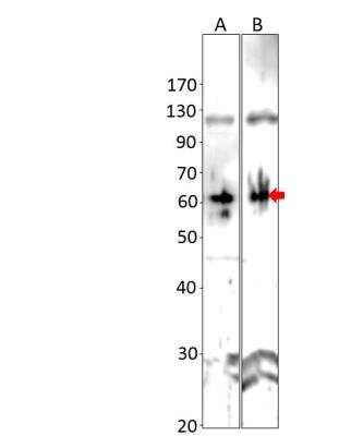 Western Blot: Axin-2 Antibody [NBP3-12289]