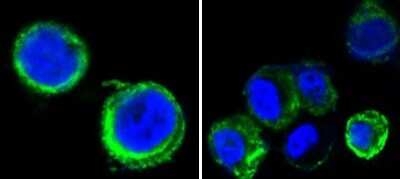Immunocytochemistry/ Immunofluorescence: Axl Antibody (7E10) - BSA Free [NBP2-37675]