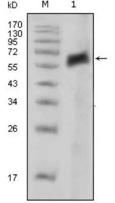 Western Blot: Axl Antibody (7E10)BSA Free [NBP2-37675]