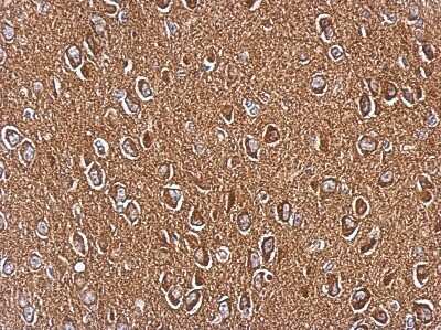 Immunohistochemistry-Paraffin: Axl Antibody [NBP2-15530]