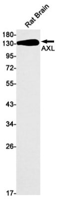 Western Blot: Axl Antibody (S06-5B2) [NBP3-20030]