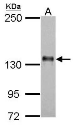 Western Blot: Axl Antibody [NBP2-15530]