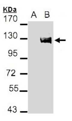 Western Blot: Axl Antibody [NBP2-15530]