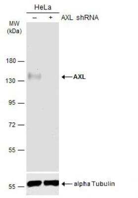 Western Blot: Axl Antibody [NBP2-15530]
